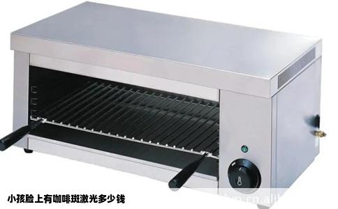 小孩脸上有咖啡斑激光多少钱